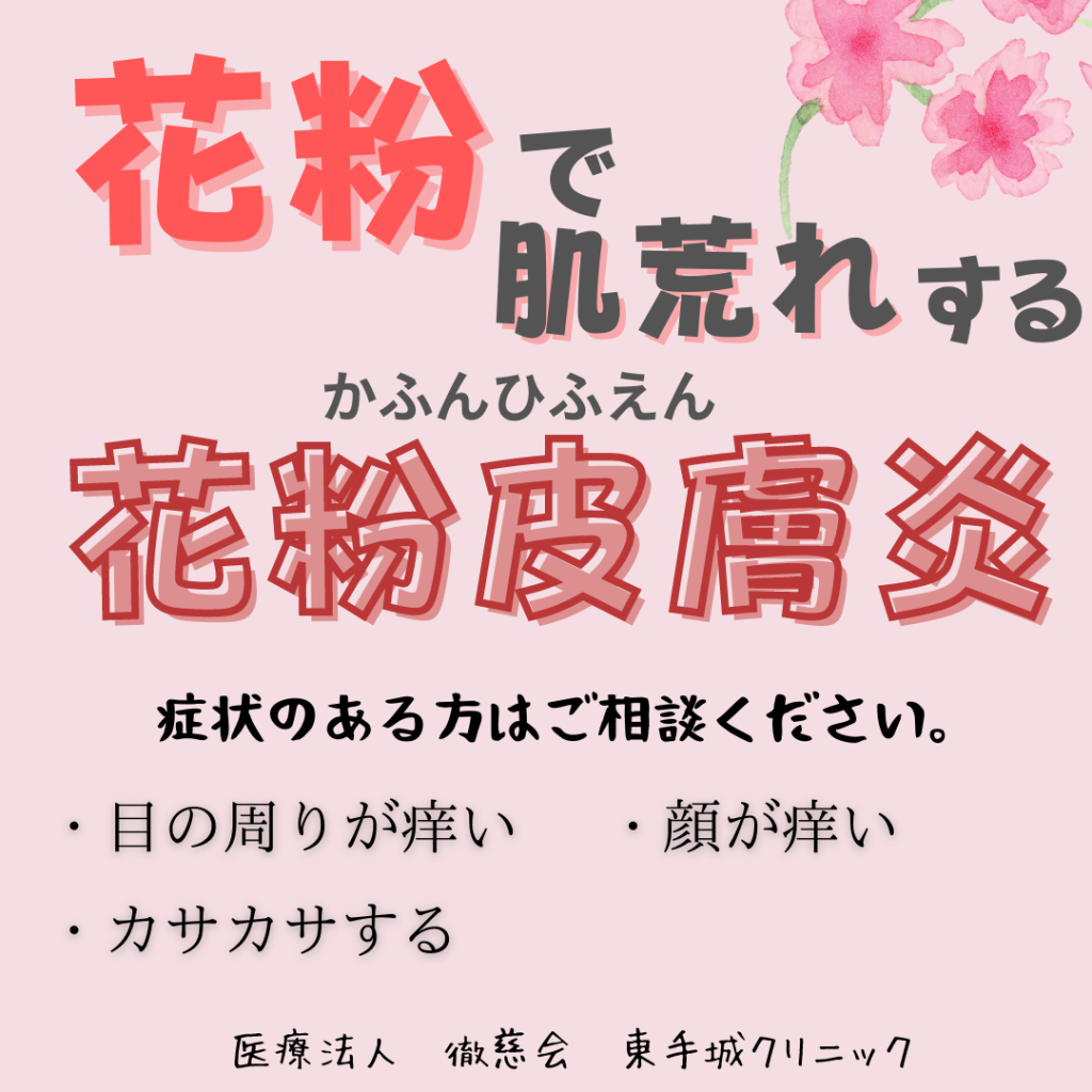 【花粉皮膚炎】があります。 福山市の皮膚科・形成外科なら形成外科・皮膚科 東手城クリニック 【花粉皮膚炎】があります。 福山市の皮膚科・形成外科なら形成外科・皮膚科 東手城クリニック